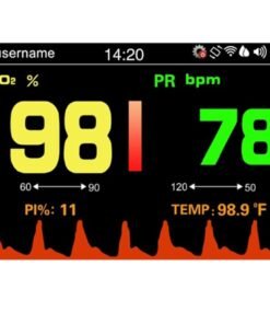 Alternative view of جهاز قياس نسبة الأكسجين المحمول SP-20 - دقة وراحة في الاستخدام